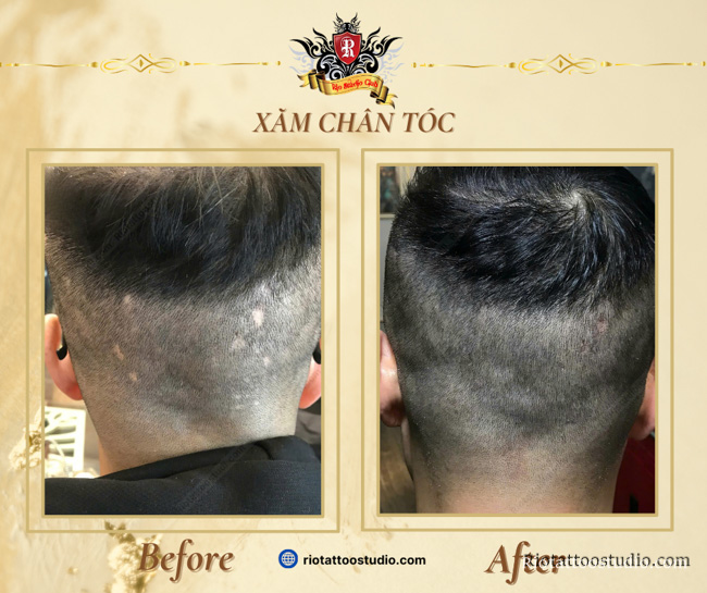 Hình ảnh trước và sau khi xăm chân tóc