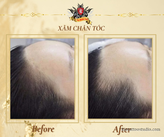 Hình ảnh trước và sau khi xăm chân tóc ở nữ.