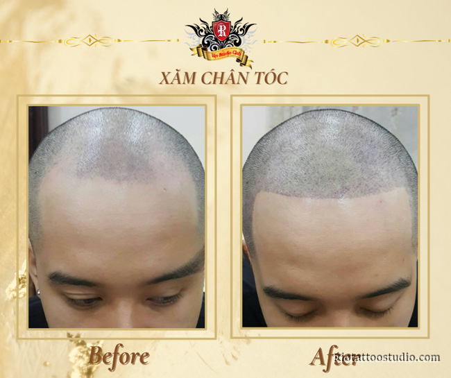 Hình ảnh trước và sau khi xăm chân tóc