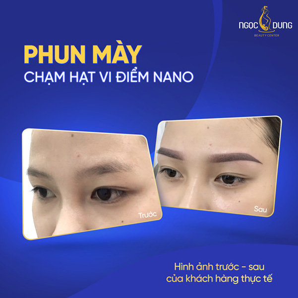 Phun mày tại thẩm mỹ viện Ngọc Dung