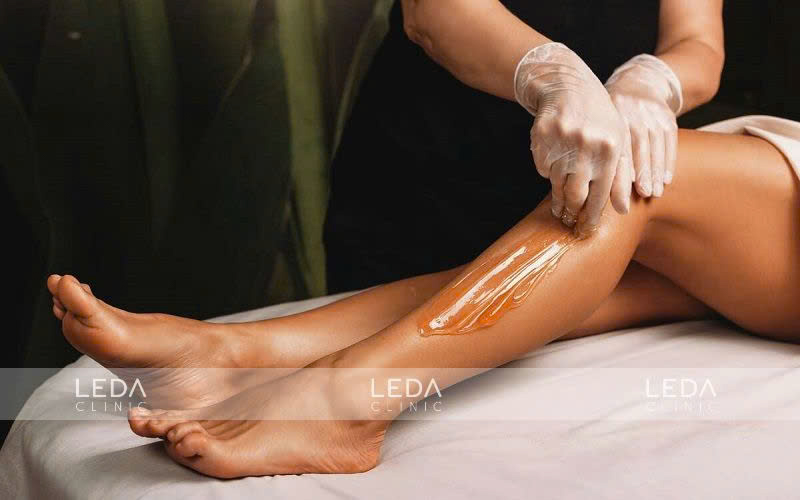 Triệt lông an toàn tại LEDA Clinic với công nghệ Diode Laser