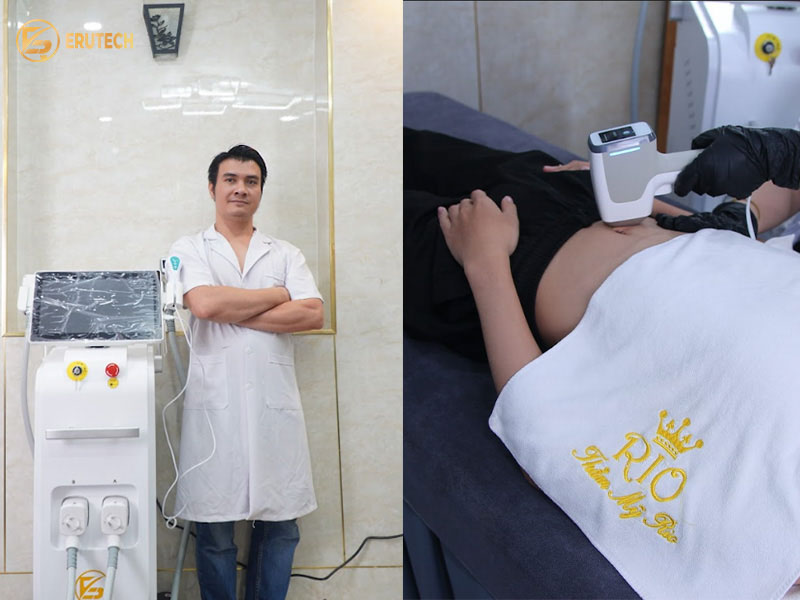 Chuyên gia của địa chỉ triệt lông nam uy tín đang thực hiện liệu trình bằng máy triệt lông công nghệ cao Erutech tại thẩm mỹ Rio.