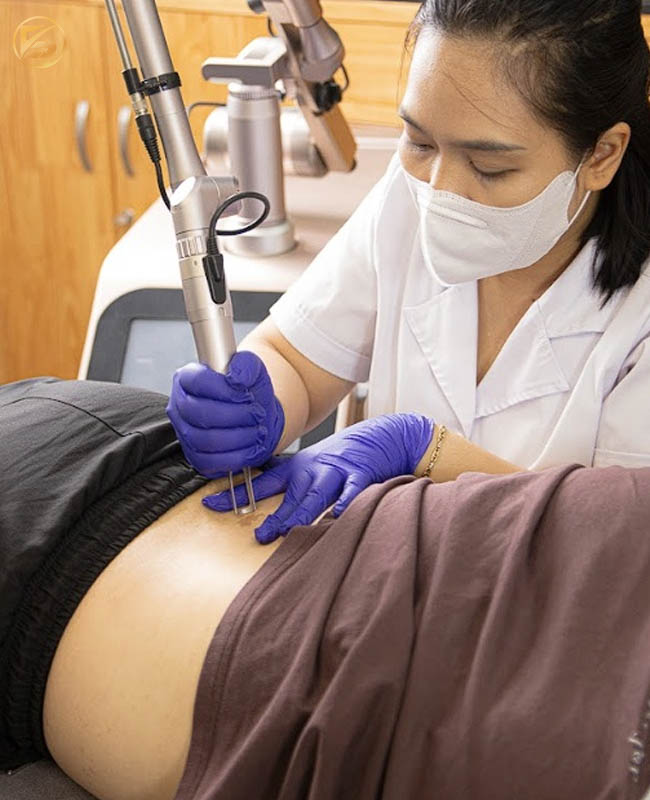 Chuyên gia tại Thẩm mỹ Rio đang tỉ mỉ xử lý mảng xăm trên lưng khách hàng bằng hệ thống máy Rio Laser Ultra Series trong một không gian khang trang.
