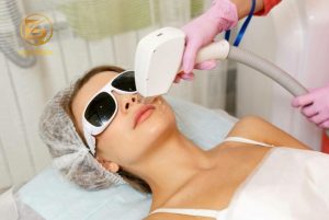 Công nghệ triệt lông Diode Laser có thời gian điều trị ngắn mang lại hiệu quả cao