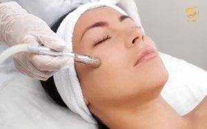 Microdermabrasion là gì?