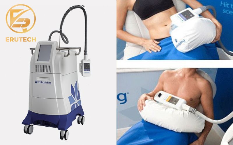 Công nghệ đông hủy mỡ Coolsculpting