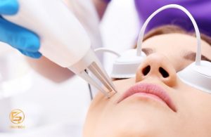 Laser CO2 Fractional bao nhiêu lần