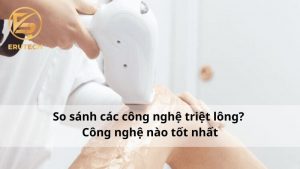 So sánh các công nghệ triệt lông