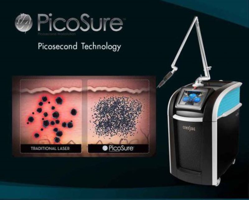 Một số chức năng chính của máy Laser Picosure