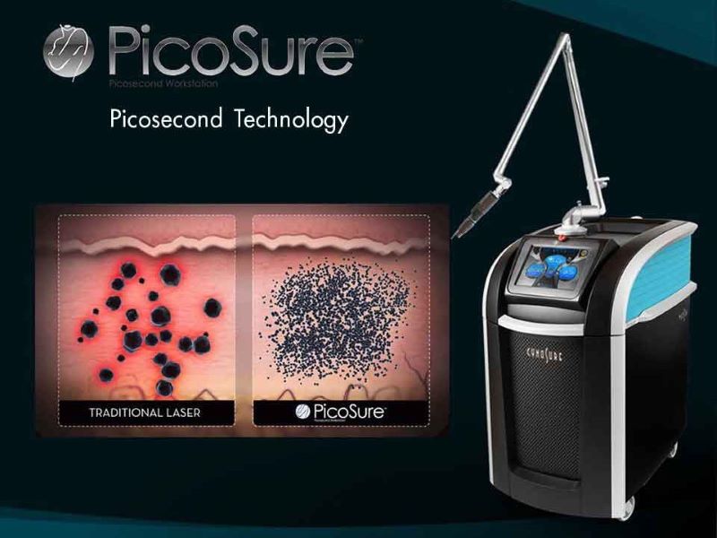 Công nghệ picosure là gì