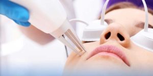 Công nghệ Laser Toning và những tác dụng tuyệt vời