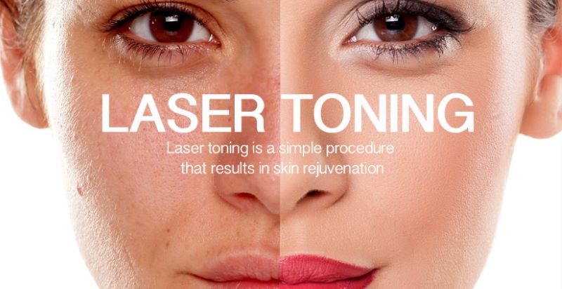 Tác dụng của Laser Toning trong làm đẹp