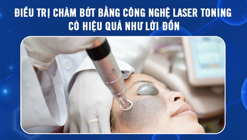 Nhược điểm của công nghệ Laser Toning