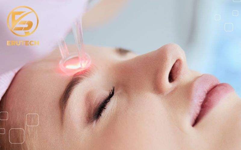 Máy laser CO2 fractional giá bao nhiêu?