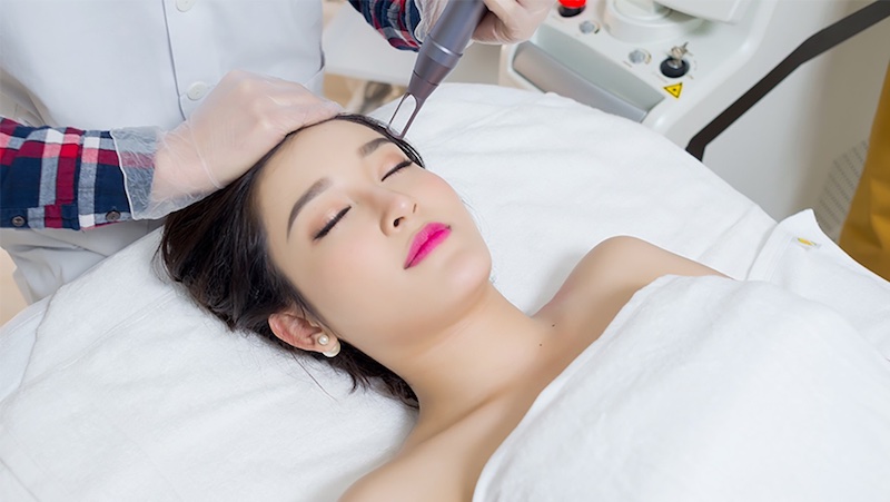 Ưu nhược điểm của Picosecond Laser là gì