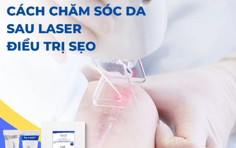 Cách chăm sóc da sau khi trị sẹo bằng công nghệ Picosecond Laser