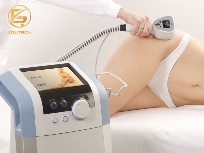 Công nghệ Exilis