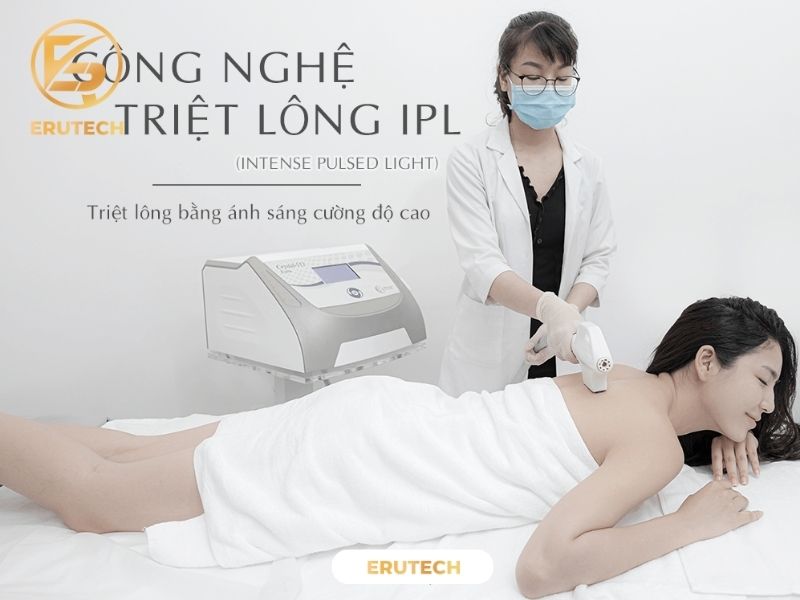 Công nghệ triệt lông IPL