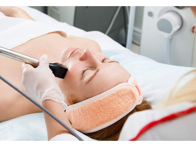 Công nghệ trị mụn Laser CO2 Fractional