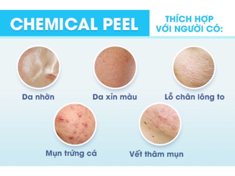 Những ai cần điều trị bằng công nghệ Chemical Peel