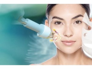 Picosecond Laser trị thâm - Công nghệ trị thâm hiện đại