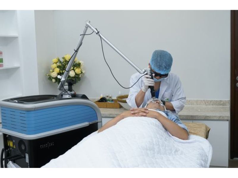 Picosecond Laser trị thâm giá bao nhiêu