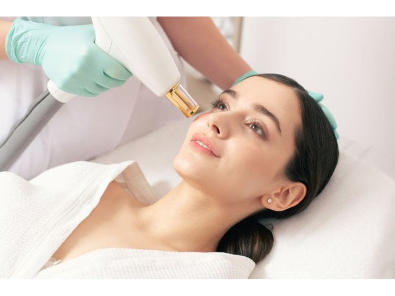 Picosecond Laser trị thâm là gì