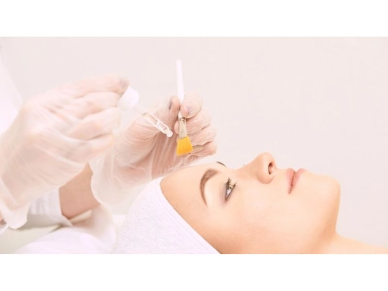 Quy trình thực hiện công nghệ trị mụn Chemical Peel