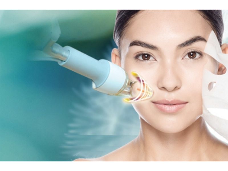 Trị nám bằng công nghệ Laser Picosure giá bao nhiêu