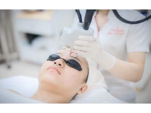 Ưu, nhược điểm của công nghệ trị mụn Laser CO2 Fractional