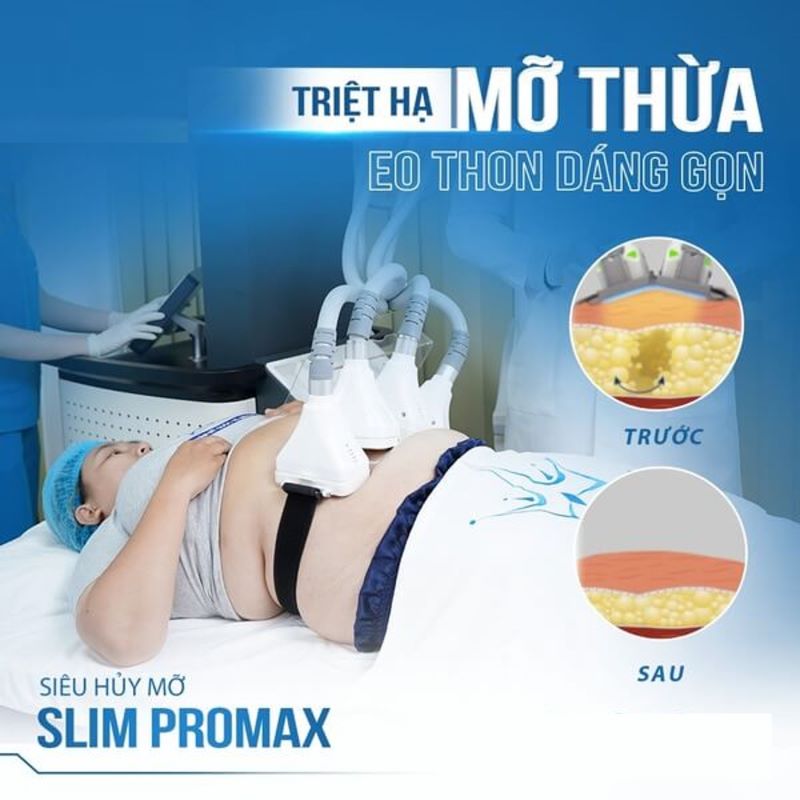 Lợi ích vượt trội của Công nghệ huỷ mỡ Slim Promax là gì?