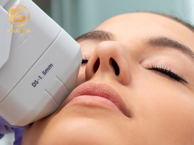 Hoạt động của Ultherapy