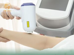 So sánh công nghệ triệt lông OPT SHR và Diode Laser loại nào tốt hơn?