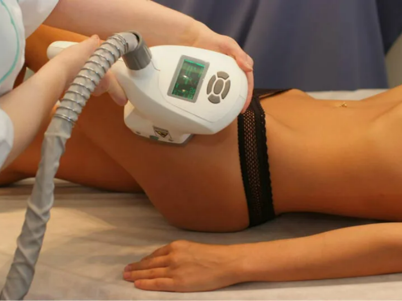 Công nghệ giảm béo Cavitation là sự kết hợp của 4 công nghệ hiện đại