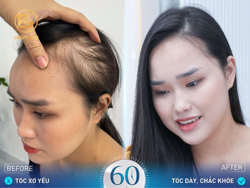 Nanomax Hair Plus mang lại hiệu quả cao