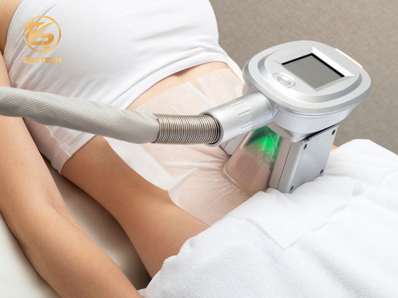 Công nghệ huỷ mỡ Cryo Lipo là gì?