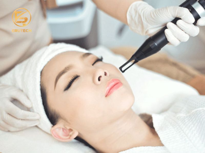 Công nghệ trị sẹo Mega Scar là gì?