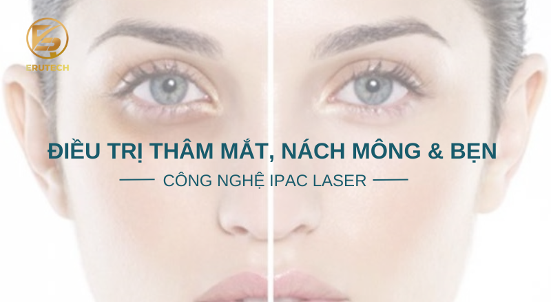 Trị thâm mắt, nách, mông & bẹn bằng công nghệ Ipac Laser