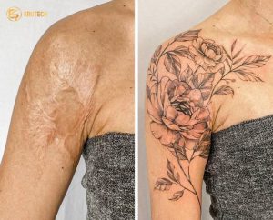 Rio Tattoo Studio với hơn 20 năm kinh nghiệm trong lĩnh vực xăm nghệ thuật đã tích lũy được kiến thức sâu sắc về các loại sẹo và phương pháp xăm che sẹo hiệu quả nhất.