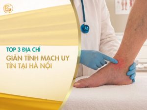 Không gian sảnh chờ vô cùng rực rỡ và tinh tế với hệ thống đèn chùm, ghế sofa êm ái cùng logo Seoul Center nổi bật, khẳng định đẳng cấp của một địa chỉ khử thâm nhũ hoa chuyên nghiệp.